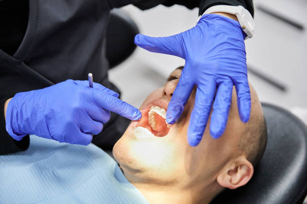 Best Emergency Dental Care for Broken or Chipped Teeth in Dunstan, ME